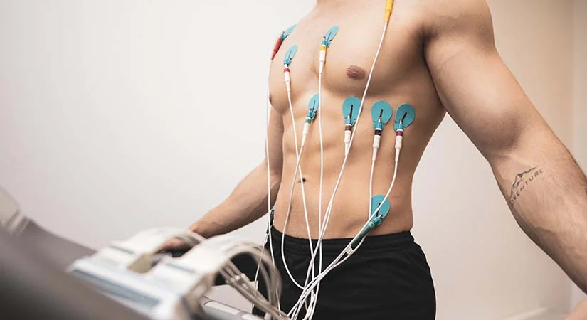 cardiac exercise stress test