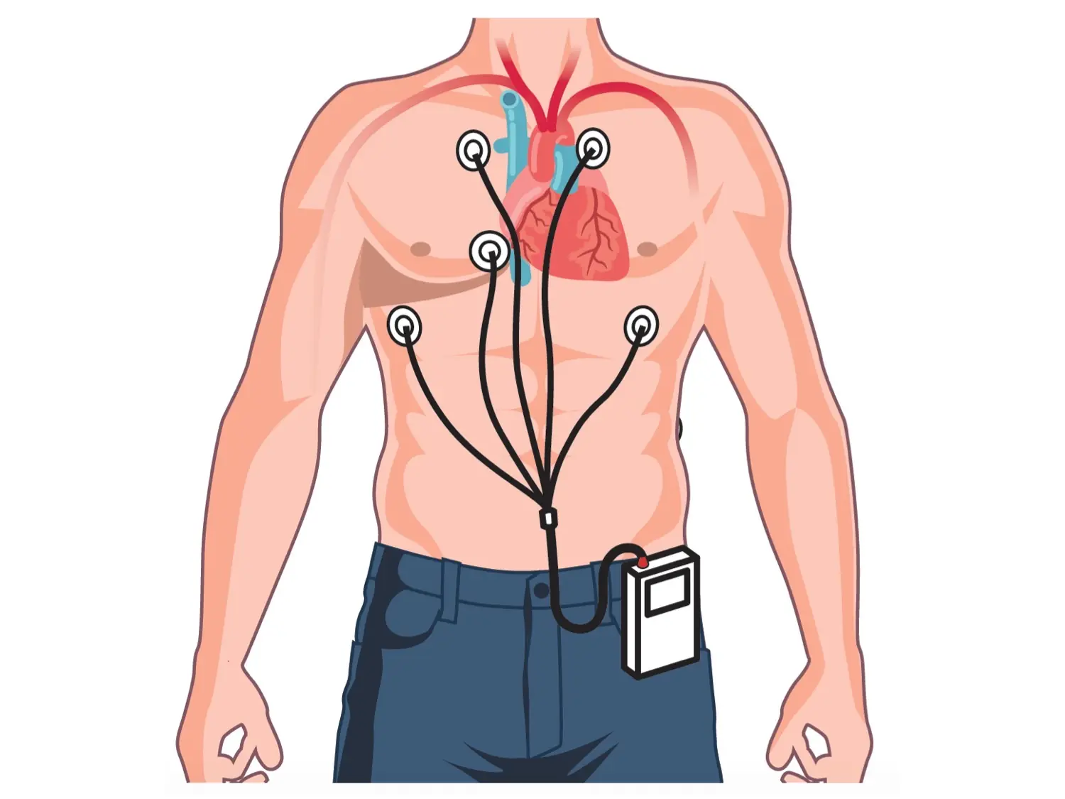 holter dibujo