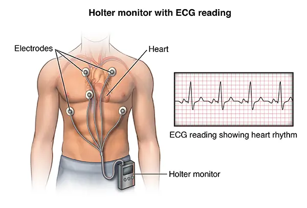 holter m