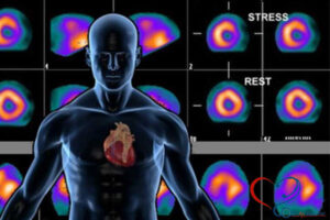 آیا اسکن قلب بهتر است یا تست ورزش؟ + 3 روش 21 اسکن قلب چیست
