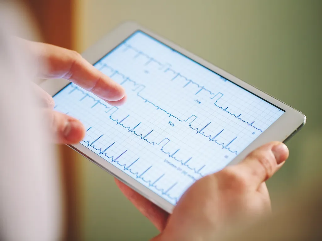 آریتمی قلبی چیست و چگونه درمان میشود؟ 17 آریتمی قلبی