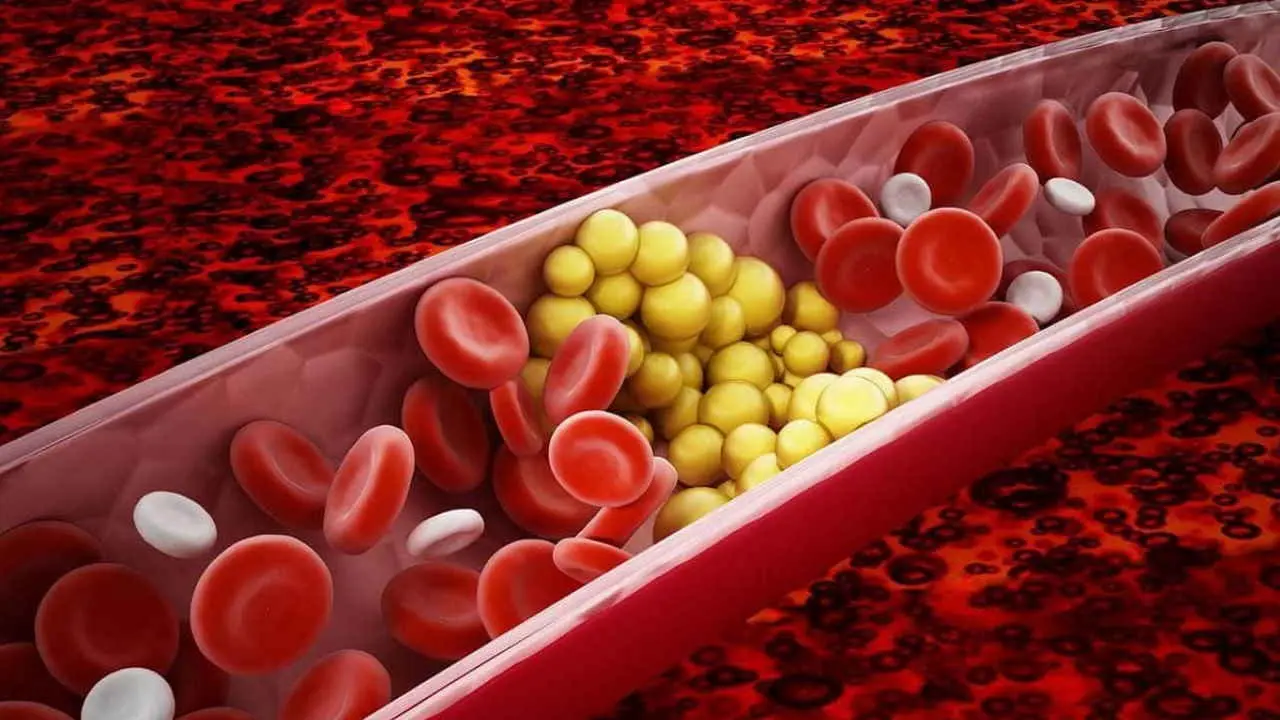 کلسترول یا تری گلیسرید کلسترول یا تری گلیسرید