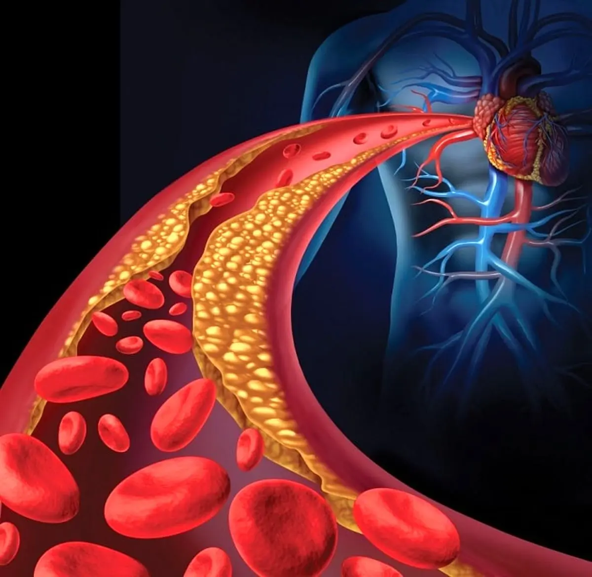 کلسترول یا تری گلیسرید کلسترول یا تری گلیسرید